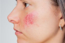 scar removal treatment in bangalore